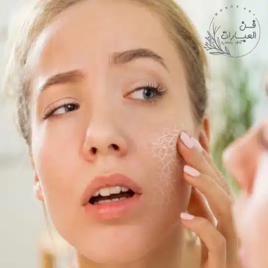 جفاف البشرة في الشتاء