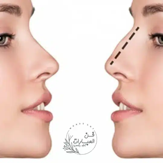 علم الفراسة