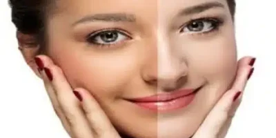 خلطات تفتيح البشرة