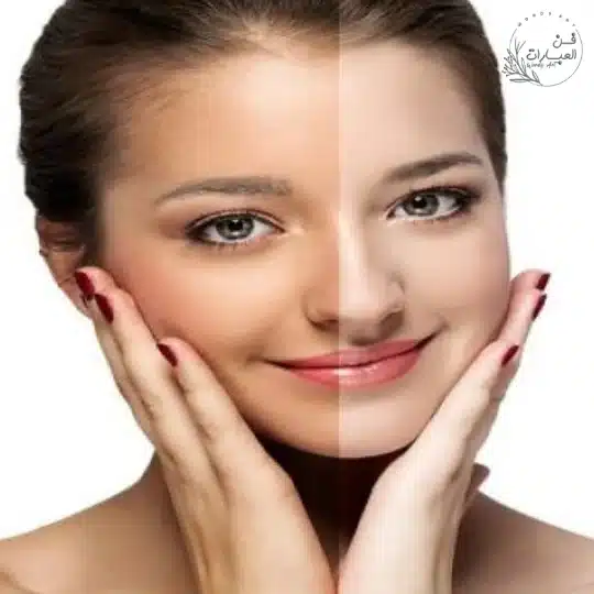 خلطات تفتيح البشرة