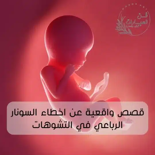 قصص واقعية عن اخطاء السونار الرباعي في التشوهات