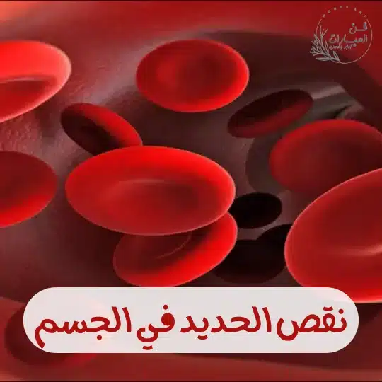 نقص الحديد في الجسم